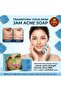 Herbal Acne Soap 12PCS COMBO PACK – Deep Cleansing & Oil Control Bar for Acne, Pimples & Smooth Skin - 2