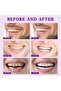2023 New Sp-7 Probiotics Whitening - 4