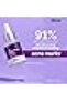 10% Niacinamide Face Serum 10ml - Blemish & Pore Minimizing Treatment for Clear Skin - 3