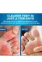 Toe Seam Itching Cream - 20g Foot Care Cream for Toe Fungus Relief,Anti-Itch Treatment for Dry Skin - 4