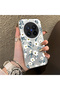 Vivo X300 Pro Compatible Hard Acrylic Back Silicone Edge Lens Protection Case - 2