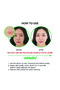 Spot Eraser Step 1 (Green - Micropoint for Early-Stage Spot) 9 Patches - 4