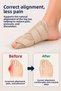 Hallux Valgus Night Splint Beige Foot Big Toe Bone Corrector Protector Orthopedic Bunion Apparatus Pain Relief Foot Correction Support Stabilizer - 3