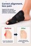 Hallux Valgus Night Splint Toe Big Bone Corrector Protector Orthopedic Bunion Apparatus Pain Reducer Foot Correction Support Stabilizer - 2