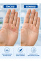 Callus Remover Solution - 8