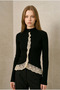Women's Black Spanish Sleeve with Gupure Detail Cardigan Yy101401 - 4