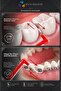 Interface Brush Dental Interdental Brush Cleaning Brush between Teeth and Braces 0.5 mm Red 6 Pieces - 2