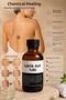Chemical Peeling & Effective Care Against Darkening and Roughness in the Knees, Elbows, Armpits, Back, and Leg Areas - 4