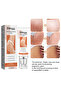 Stretch Mark Removal Cream Treatment Scars Acne Stretch Marks Remove Postpartum Anti Wrinkle - 4