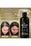 Professional Hair Regrowth Shampoo 300ml, Scalp Hydration And Follicle Rejuvenation Formula - 4