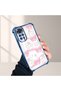 Xiaomi Redmi Note 11 Compatible Transparent Back Four-Corner Reinforced Impact Protection Silicone Case - 5
