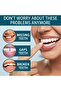 Snap On Smile Veneers Adjustable Dentures Set - Temporary Fake Teeth Cover for Dental Protection & Aesthetic Enhancement, Portable - 6
