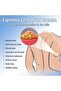 Lipoma Removal Cream, Underarm And Neck Lymphatic Care Cream, Anti-Cellulite Remover Cream 50g - 5