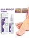 Fungus Spray Toenail Fungus Treatment Nail Fungus Toenail Treatment - 3