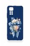 Redmi Note 11S Compatible Blue Ribbon Flower Pattern Silicone Case - 3