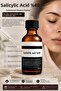 Effective Professional Experience with Salicylic Acid 40% Chemical Peeling Against Blackheads, Acne, and Oily Appearance Problems - 2