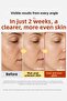 Sungboon Kojic Acid Niacinamide Ampoule - Anti-Blemish Ampoule - 6