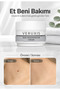Veruxis Skin Regenerator 25 ml Cosmetic Care Cream for Warts/Meat Moles/Corns - 6