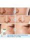 Kind to Skin Soothing Freckle Cream - 3