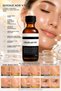 With 10% Glycolic Acid, It Helps to Create a Brighter, Smoother, and Revitalized Skin & Even Out Skin Tone and Reduce the Appearance of Pores. - 2