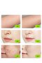 T14 5 in 1 IPL Hair Removal Device, 3℃ Ice Cooling Laser Hair Removal 0.5s/Flash Sky Blue - 2