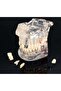 Dental Anatomical Cast Model - 2