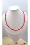 Red Bone Model Acrylic Necklace
