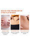 Stretch Mark Removal Cream Treatment Scars Acne Stretch Marks Remove Postpartum Anti Wrinkle - 3
