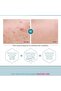 Acne Toner 150ml - 4