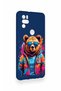 Omix X300 Compatible Bear Patterned Silicone Case with Glasses - 2