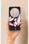 Mi 15 Ultra Compatible Matmazel Patterned Silicone Case