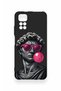 Redmi Note 11S Compatible Pop David Patterned Silicone Case - 2