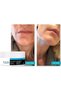 Dr. Botokss Skin-Regenerating Treatment Cream 50 ml x 1 GEN01 - 2
