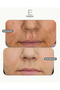 Sunscreen for More Sensitive Skin Spf50+ High Protection, Non-Stinging, Non-Sweating, Anti-Blemish, with Brightening Effect - 2