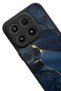 Xlaomi Mi 17 5g Compatible Marble Design Glossy Premium Case - 2