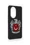 Honor 200 Pro 5g Compatible Turkish Arma Patterned Silicone Case - 4