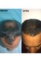 Essential Oils for Hair and Skin Care - 150 Ml Rosemary - 2