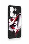 Redmi Note 13 Pro 4g Compatible Mademoiselle Patterned Silicone Case - 3