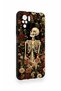 Redmi Note 10-10S Compatible Flower Skeleton Pattern Silicone Case - 2