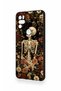 Omix X300 Compatible Flower Skeleton Patterned Silicone Case - 4