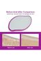 Crystal Depilator, Nano Depiator,Glass Depiator, Painless Epilator for Woman, Reusable Nanocrystals Epilator, Legs, Arms and Back Hair Removal Tools - 2
