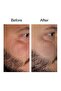Starter Retinol Serum - Retinol Starter Serum 30 ml - 5