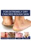 Ultra Moisturizing Cream,Foot And Hand Cream With Shea Butter & Beeswax,Cracked Heel Repair Cream - 6
