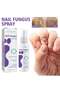 Fungus Spray, Nail Fungus Treatment For Toenail And Nail Strengthener - 2