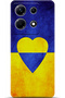 Infinix Note 30 Case Hd Printed Case - They Can'T Bring Me down 5581