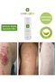 Intensive Moisturizing Skin Care Cream for Atopic, Dry and Eczema-Prone Skin 100 ml 3 Pcs - 7