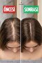 Tempoxil Anti Hair Loss Shampoo - 2