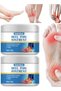 Heel Pain Ointment (30g) - Natural Foot & Joint Pain Relief Cream - 3