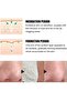 Nose Plants Pore Strips, Deep Cleaning And Shrink Pores,Absorb Grease, Remove Blackheads Nose Patch - 4