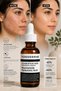 Salicylic Acid Serum with 2% Bha Content, Niacinamide and Hyaluronic Acid Supported Anti-Blackhead Care Serum for Oily and Acne-Prone Skin - 7
